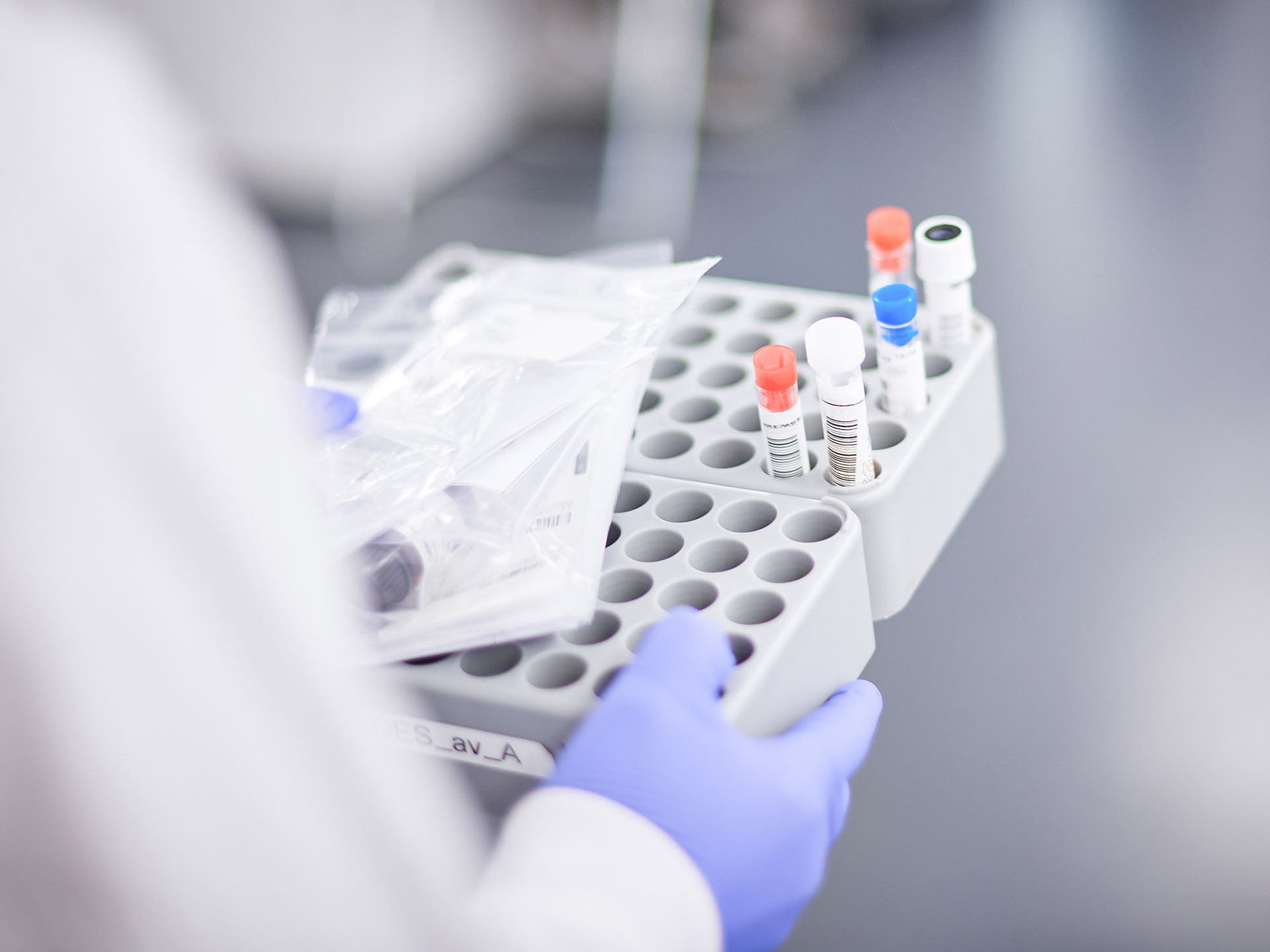 Steroid hormone analysis